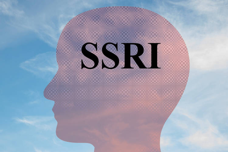 Selective Serotonin Reuptake Inhibitors Ssris For Depression