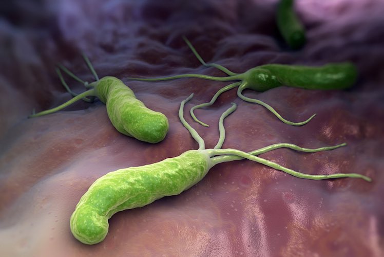 Helicobacter Pylori Test Simple Test For Stomach Germ Mydr Com Au
