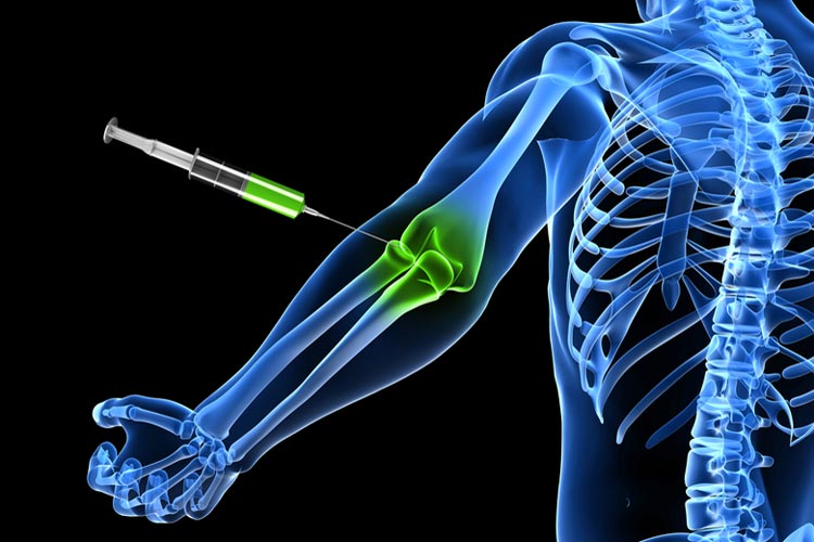 Corticosteroid Injections MyDr au corticosteroid-injections-mydr-au