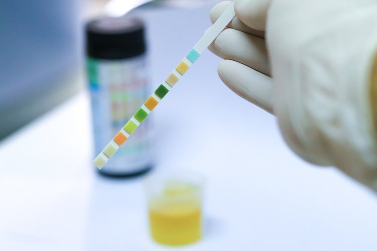 Urinary Tract Infections In Children Mydr Com Au