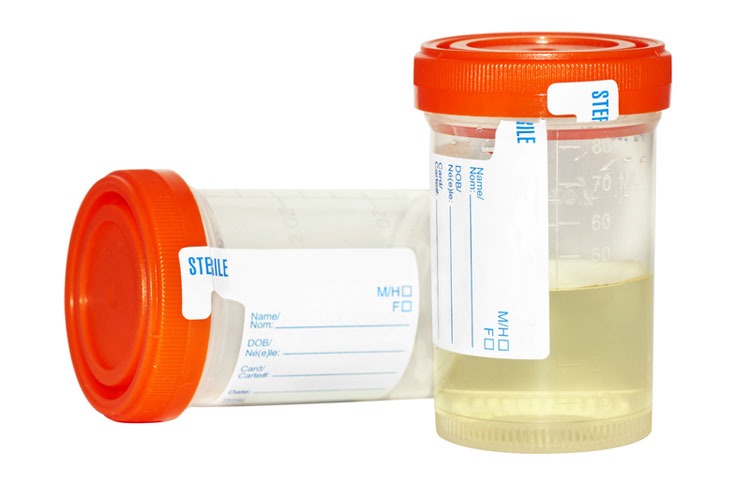 Urinary tract infection (UTI) - myDr com au