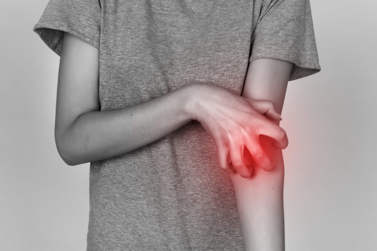 Eczema