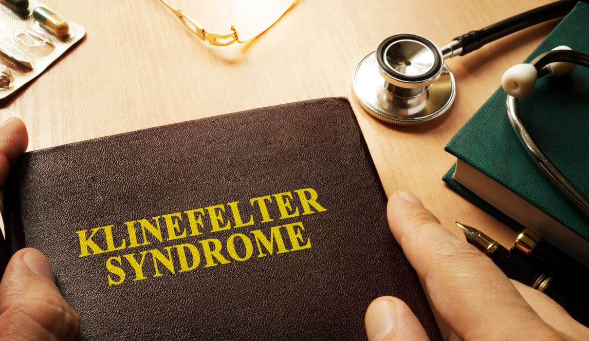 klinefelter syndrome