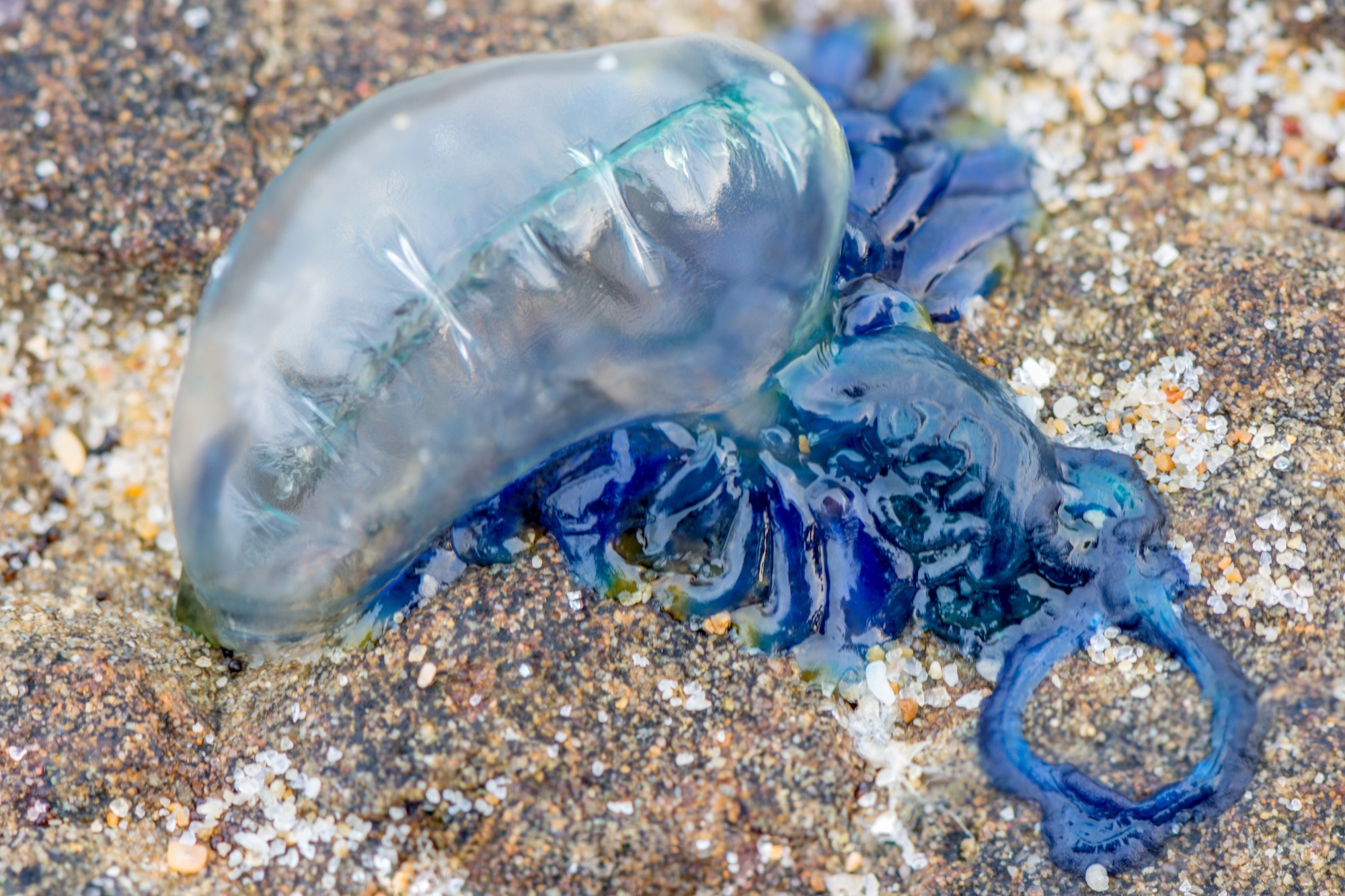 How Do You Treat a Blue Bottle Sting? Dr. Norman Swan