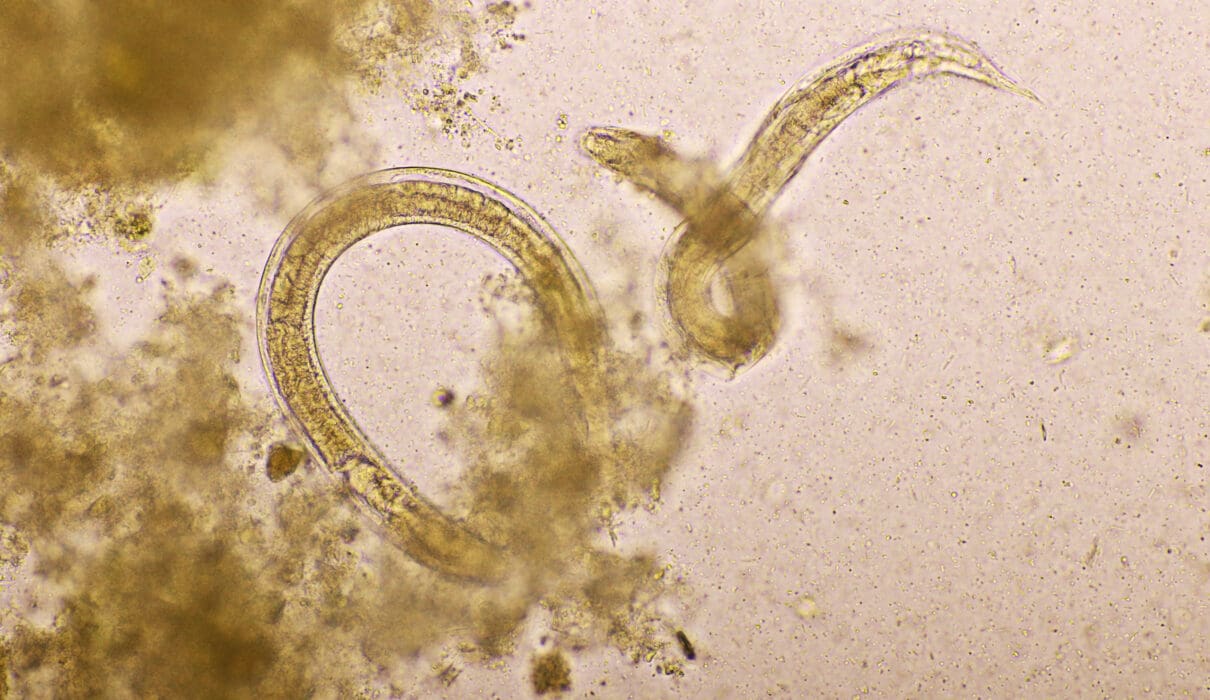 How do you catch Pinworms? Dr. Norman Swan