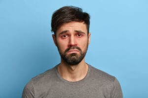 Conjunctivitis